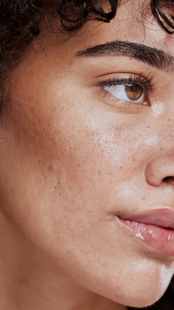 the-best-gentle-but-active-skincare